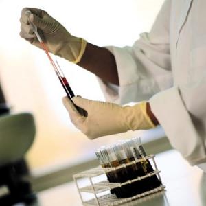 Ministério quer incluir Aids nos exames de rotina