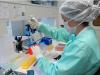 Anvisa autoriza teste em humanos para vacina contra dengue