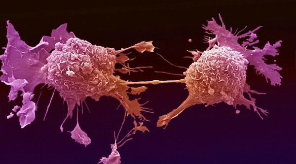 Pesquisadores nos EUA descobrem como ‘desligar’ células cancerígenas