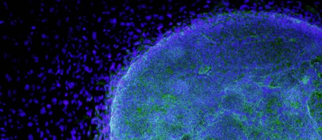 Cientistas criam "blocos" de células-tronco