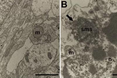 Experimento flagra zika atacando neurônios pela primeira vez