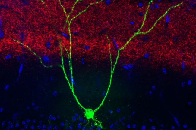 Memória perdida por Alzheimer pode ser recuperada, diz estudo