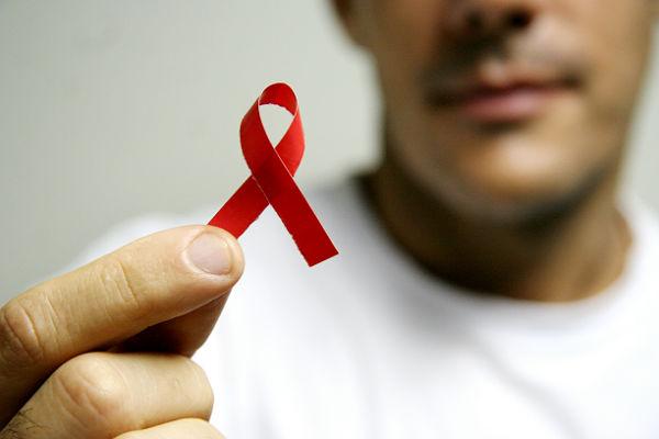 Pesquisadores tentam controlar HIV sem antirretroviral