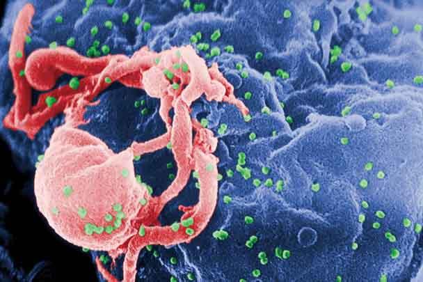 Estudo descreve método para 'treinar' anticorpos contra o HIV