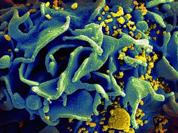 Uma em cada dez crianças com HIV é imune à Aids, indica estudo