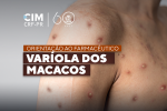 Orientação ao Farmacêutico - Varíola dos macacos